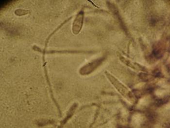 Microsporum spp.