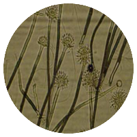 Aspergillus versicolor