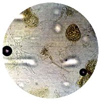 Aspergillus glaucus (Eurotium spp.)