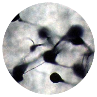 Gliocladium sp. (Trichoderma sp.)