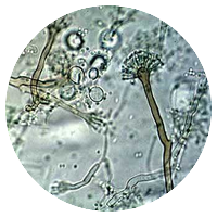 Aspergillus nidulans (Emericella spp.)